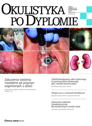 Okulistyka po Dyplomie 05/2012