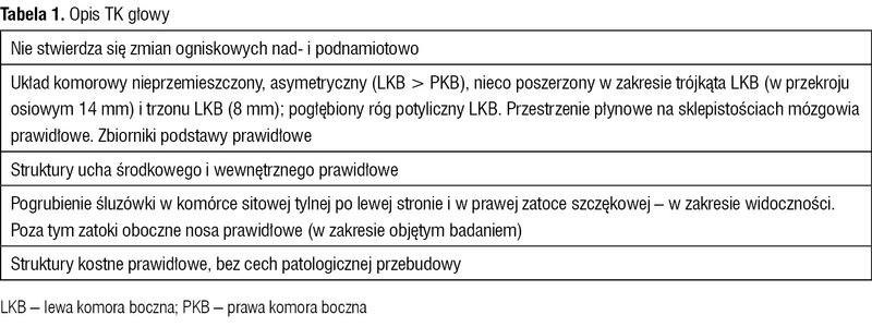 Tabela 1. Opis TK głowy