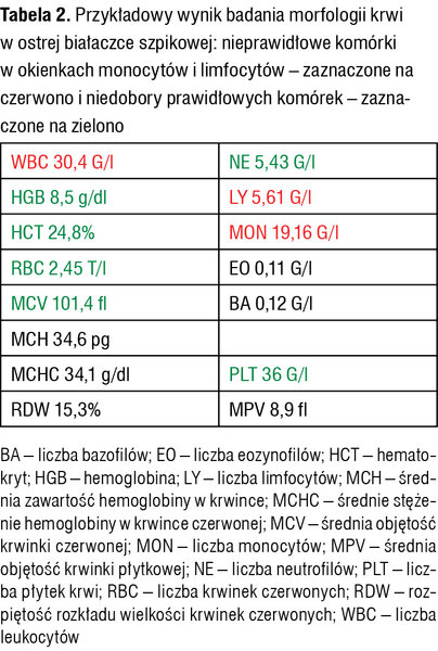 Tabela 2. Przykładowy wynik badania morfologii krwi w ostrej białaczce szpikowej: nieprawidłowe komórki w okienkach monocytów i limfocytów – zaznaczone na czerwono i niedobory prawidłowych komórek – zaznaczone na zielono
