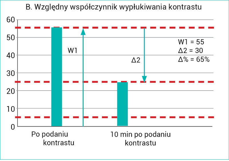 Rycina 2A, B. Schematycznie przedstawiony sposób wyliczenia współczynników wypłukiwania środka kontrastującego: bezwzględnego (preferowany; A) i względnego (B)