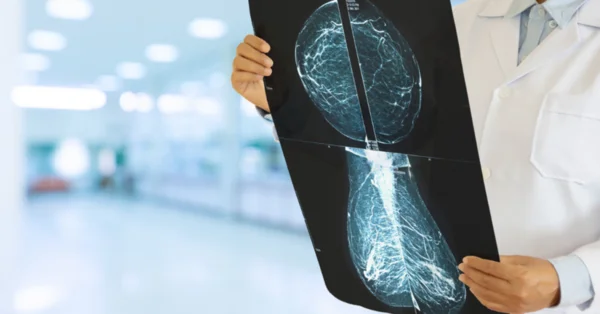 Dofinansowanie na mammografy w Zachodniopomorskim Centrum Onkologii