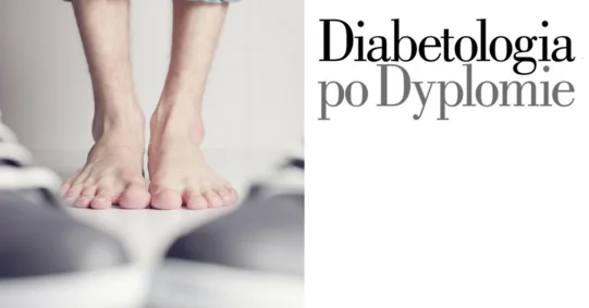 Zespół stopy cukrzycowej – praktyczne porady