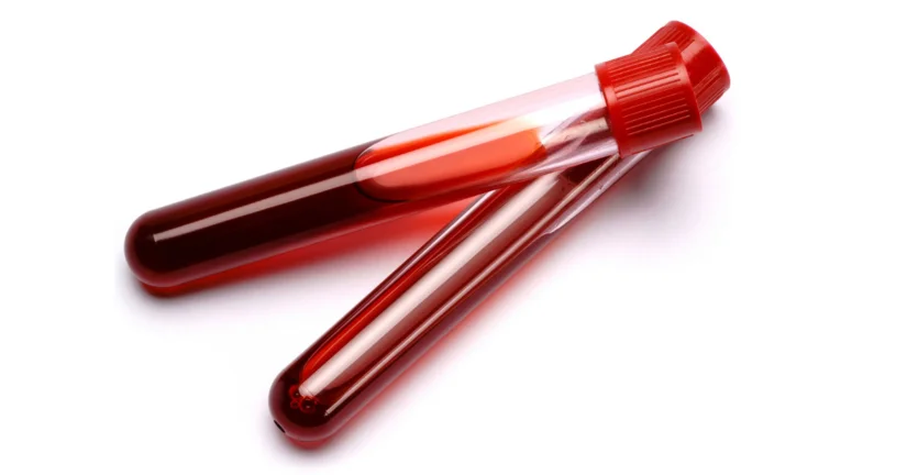 Testy na HIV. Komu i jak je zlecić? Powstał poradnik dla lekarzy rodzinnych