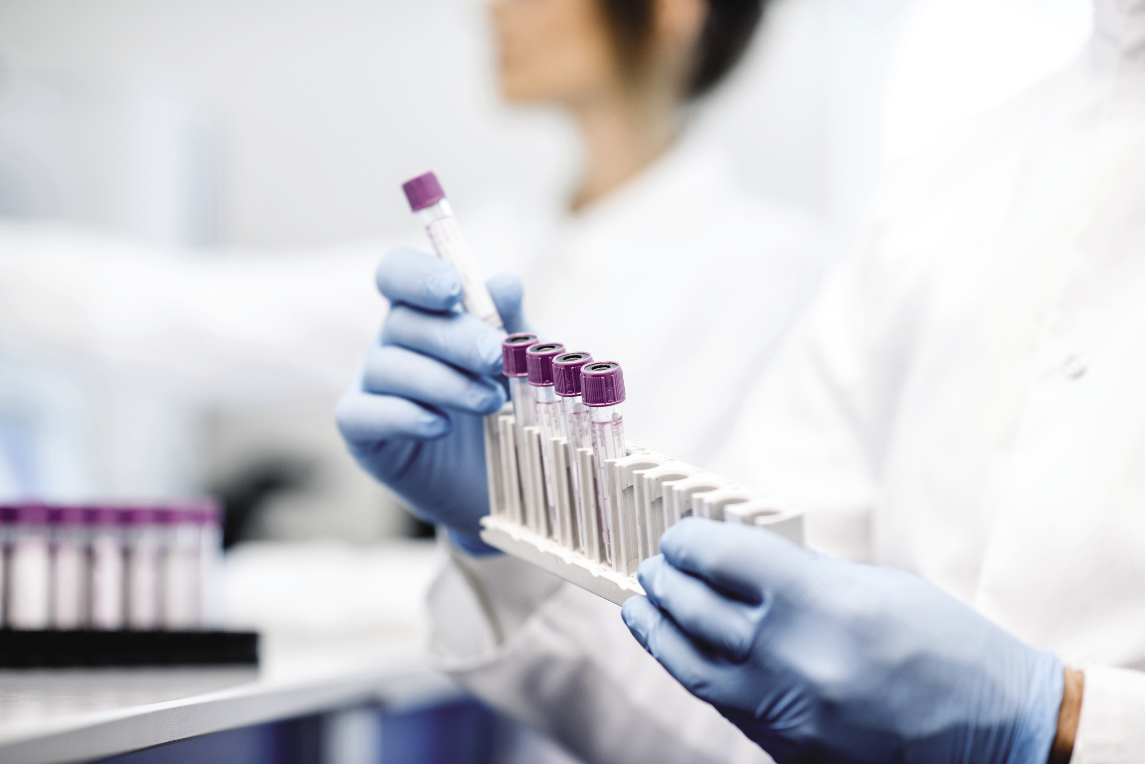 Laboratoryjne tropy w hematologii