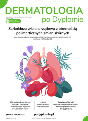 Dermatologia po Dyplomie 04/2025