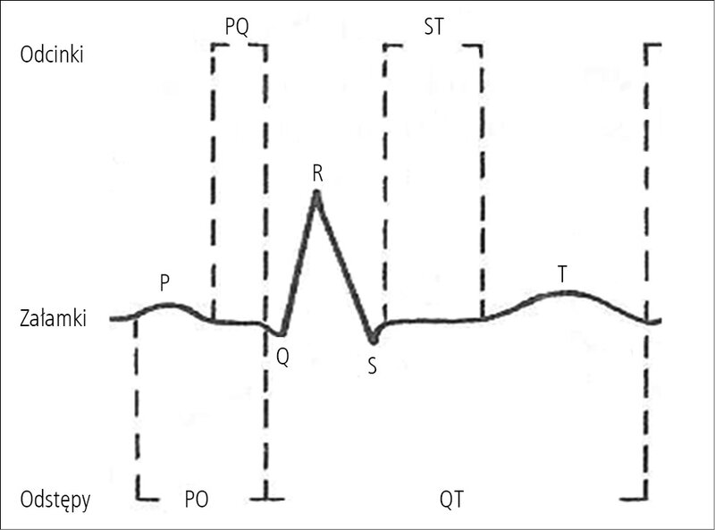 Rycina 1. Zapis EKG.