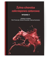 Żylna choroba zakrzepowo-zatorowa - wydanie II 