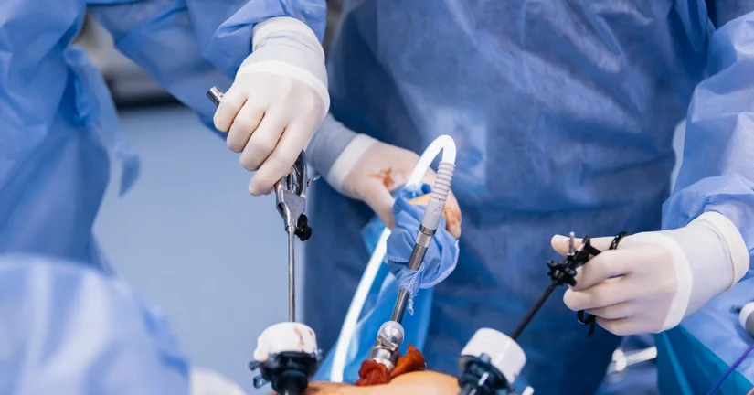 Szpital Bonifratrów w Krakowie rozpoczął operacje bariatryczne
