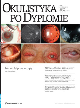 Okulistyka po Dyplomie (04/2016) 
