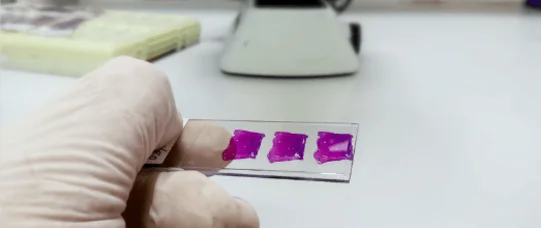 Nowe rekomendacje PTGiP w sprawie cytologii