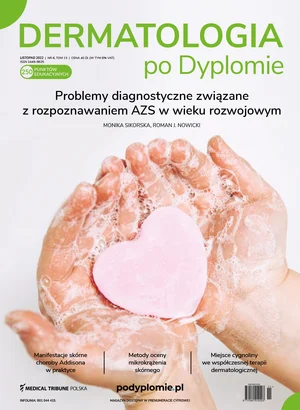 Dermatologia po Dyplomie 06/2022