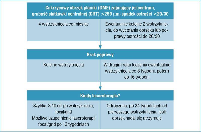 
 
 
 
 Rycina 6. Schemat leczenia cukrzycowego obrzęku plamki 