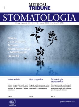 Medical Tribune Stomatologia (07/2018) 