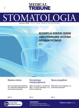 Medical Tribune - stomatologia (03/2019) 