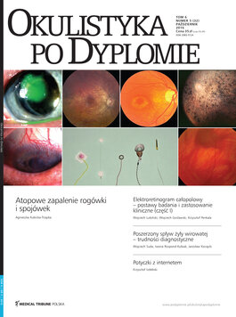 Okulistyka po Dyplomie (05/2016) 