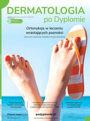 Dermatologia po Dyplomie 04/2022