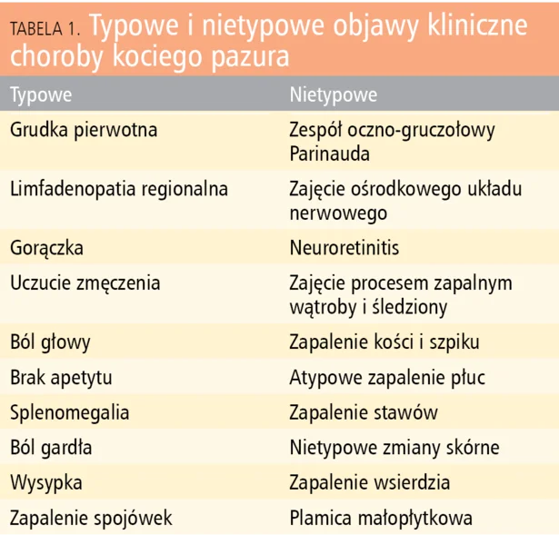 Tabela 1. Typowe i nietypowe objawy kliniczne choroby kociego pazura