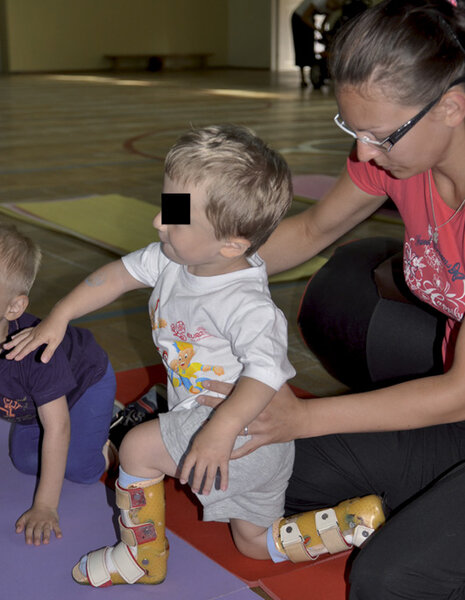 Rycina 6 A&nbsp;i&nbsp;B. Obciążanie osiowe kończyny dolnej.