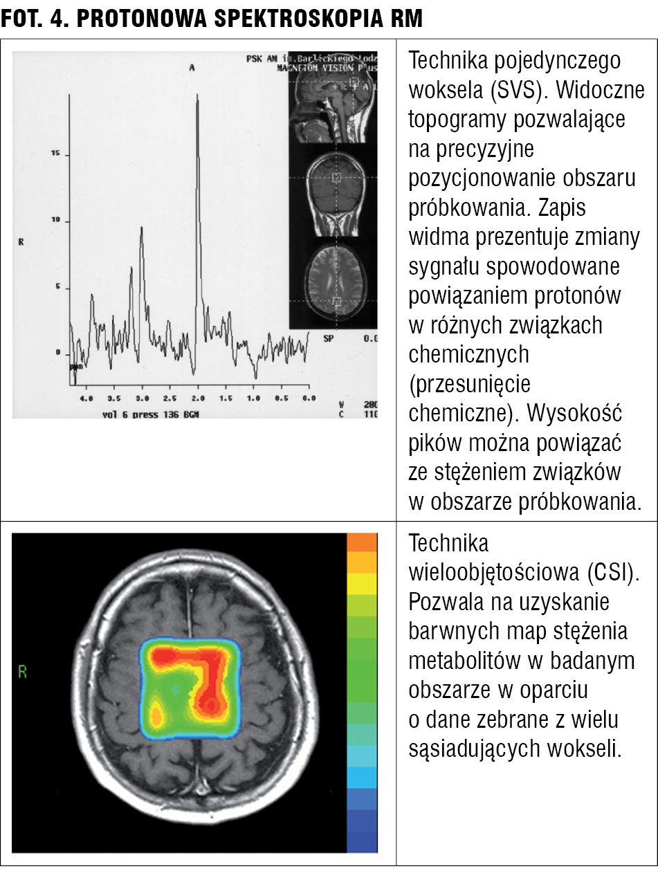 Użyteczność tomografii komputerowej i rezonansu magnetycznego w psychiatrii
