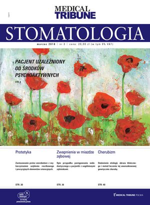 Stomatologia po Dyplomie 03/2018