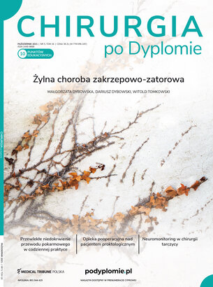 Chirurgia po Dyplomie 05/2021