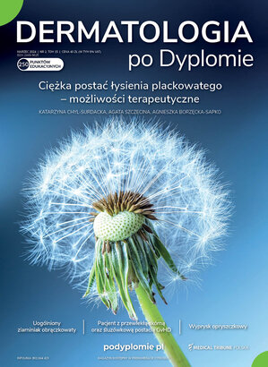 Dermatologia po Dyplomie 02/2024