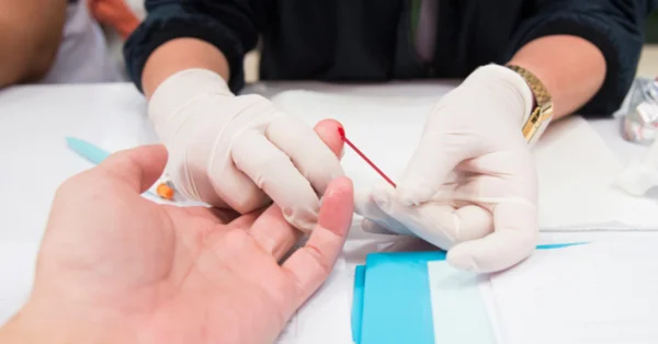 Testy na HIV w gabinetach lekarzy rodzinnych? Wkrótce będzie to możliwe