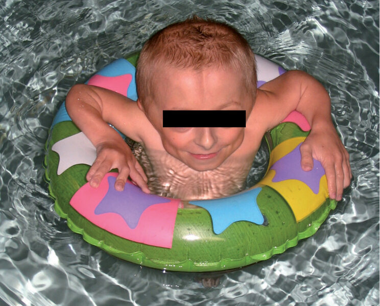 Rycina 3. Ćwiczenia w&nbsp;wodzie w&nbsp;odciążeniu z&nbsp;wykorzystaniem koła.