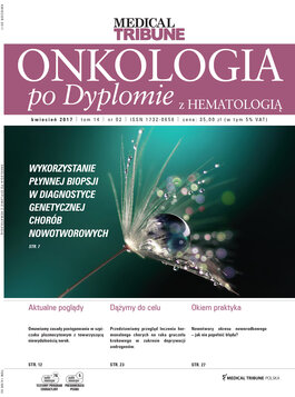 Onkologia po Dyplomie (02/2017) 