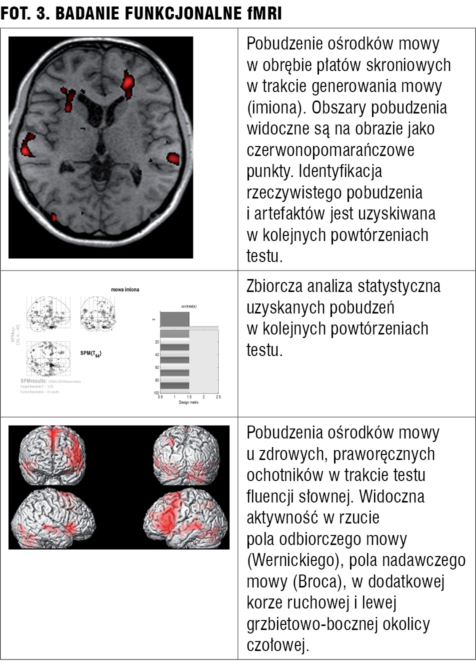 Użyteczność tomografii komputerowej i rezonansu magnetycznego w psychiatrii
