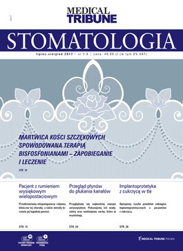Stomatologia po Dyplomie (07-08/2017) 