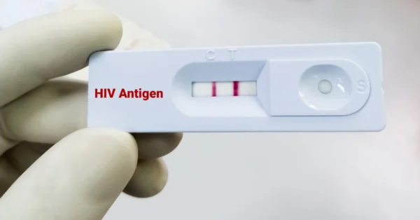Europejski Tydzień Testowania HIV: lekarze włączają się w kampanię