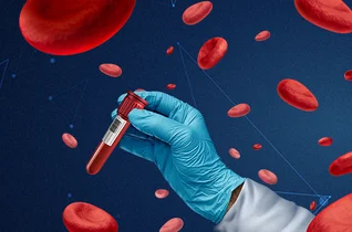 Hematologia i transfuzjologia w walce z niedokrwistością – ekspercki dwugłos od morfologii po transfuzję