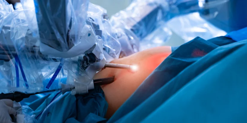 Pierwsza operacja częściowej nefrektomii nerki przy użyciu robota da Vinci w województwie podkarpackim