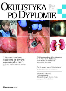 Okulistyka po Dyplomie (05/2012) 