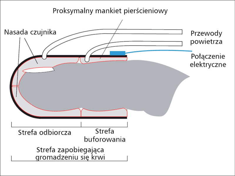 Rycina 1. Schemat konstrukcji czujnika zapisującego zmiany napięcia tkanek.