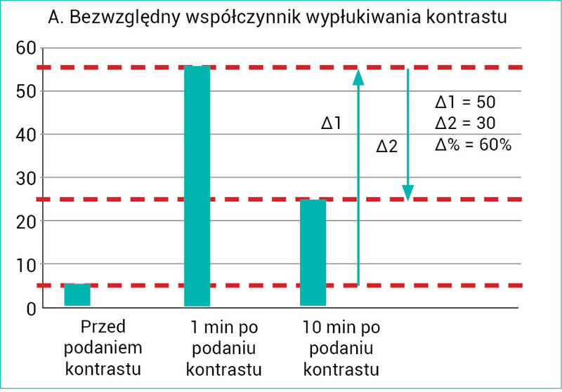 Rycina 2A, B. Schematycznie przedstawiony sposób wyliczenia współczynników wypłukiwania środka kontrastującego: bezwzględnego (preferowany; A) i względnego (B)