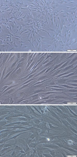 Ryc. 2. Chondrocyty izolowane z tkanki chrzęstnej w dwutygodniowej hodowli in vitro.