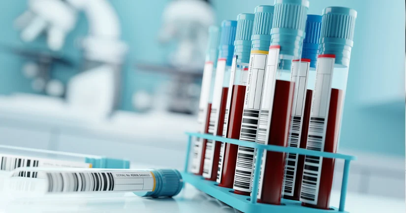 Diagności zyskali poparcie dla laboratoryjnej porady diagnostycznej