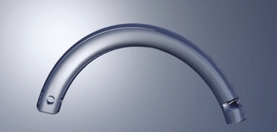 Rycina 3. Implant śródrogówkowy Ferrara ring. Dzięki uprzejmości AJL Ophthalmic