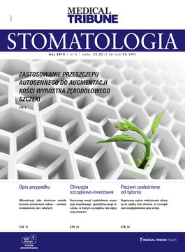 Medical Tribune - stomatologia (05/2018) 