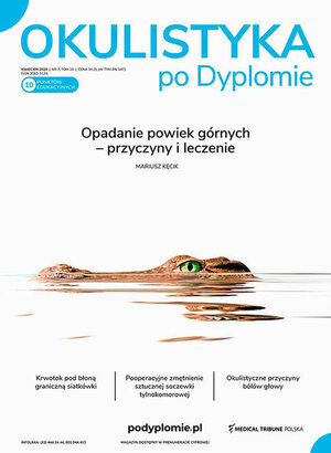 Okulistyka po Dyplomie 02/2020