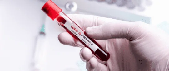 NFZ zaniża cenę testów na SARS-CoV-2?