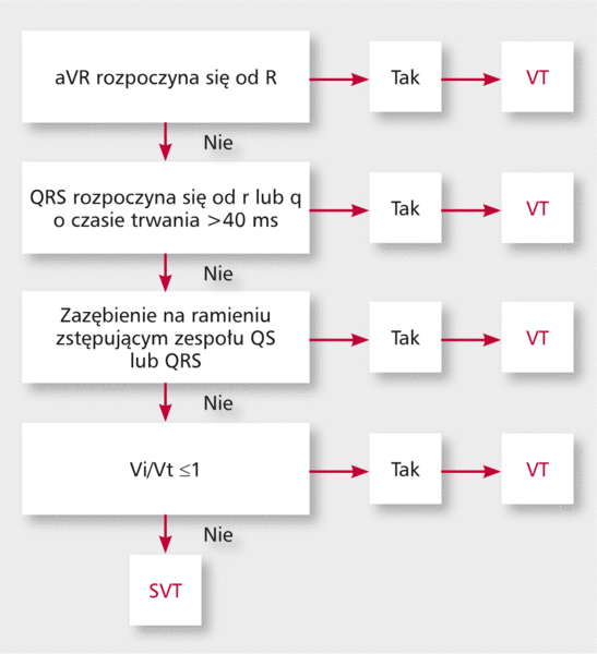 Rycina 7. Algorytm wg odprowadzenia aVR.