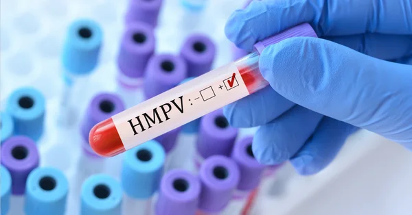 Położne szkolą się w pobieraniu testu HPV HR