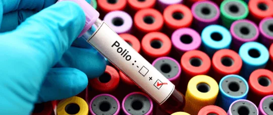 Czy zagraża nam polio z Ukrainy? 