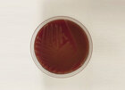Hodowla Enterococcus