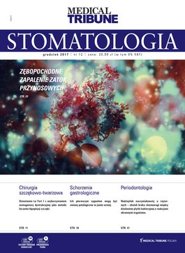 Medical Tribune Stomatologia (12/2017) 