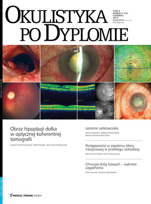 Okulistyka po Dyplomie 03/2014