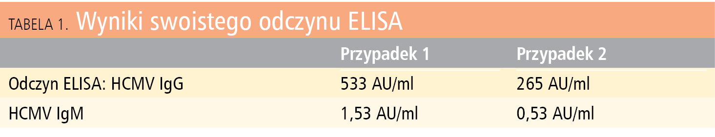 Tabela 1.&nbsp;Wyniki swoistego odczynu ELISA&nbsp;